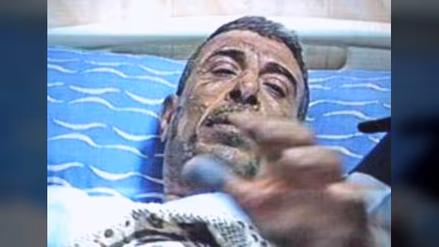 في سادس حالة.. مصري يحاول إشعال النار في نفسه أمام مجلس الوزراء