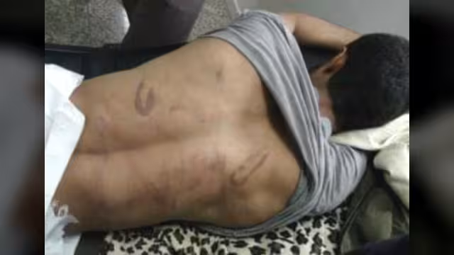 صور تظهر آثار تعذيب الحوثيين لأربعة معتقلين نقلوا إلى صنعاء