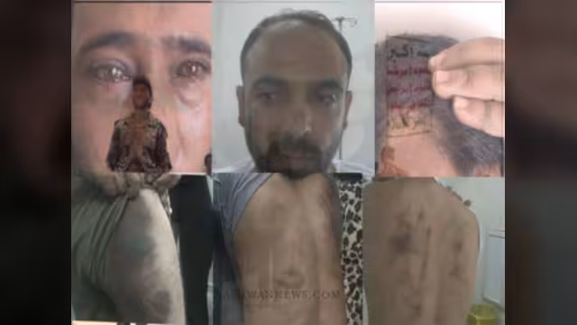 تحقيق موسع عن سجون الحوثيين وأوضاع المعتقلين وقصص التعذيب الوحشي‏‏ (النص)‏