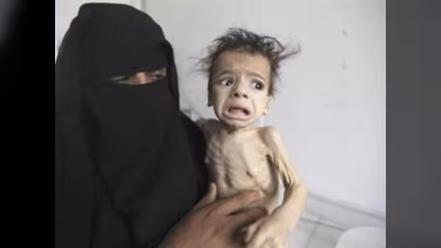 اليونيسف: ملايين الأطفال باليمن معرضون للأمراض