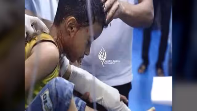 "لا تقبروناش"...آخر صرخات طفل اليمن