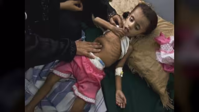 قلق دولي من تدهور الوضع الإنساني في اليمن