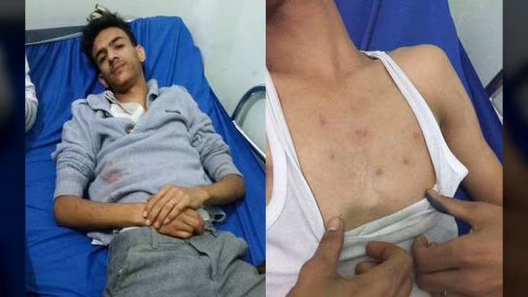 الحرب ضد الصحافيين" في اليمن... تنتقل إلى الأبناء
