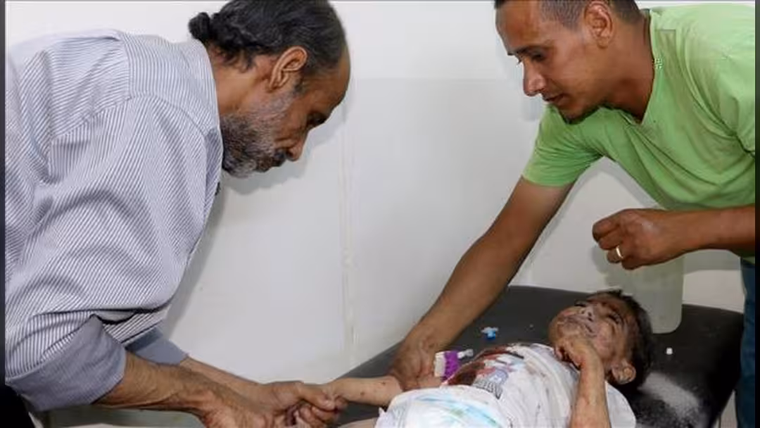 الصحة العالمية: 14 مليون يمني بحاحة لخدمات صحية عاجلة