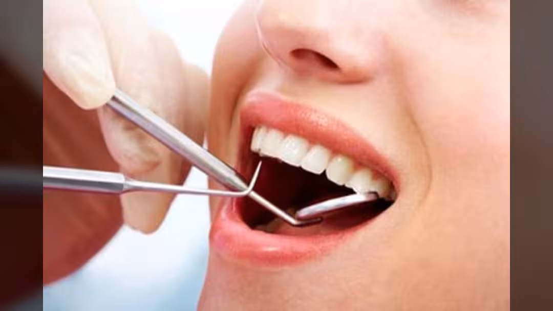 الاهتمام بصحة الأسنان يقي من علاجات العصب