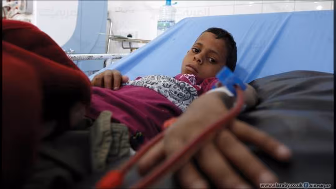 الصحة العالمية: 18 إصابة و340 حالة اشتباه بمرض الكوليرا في اليمن.. بيان