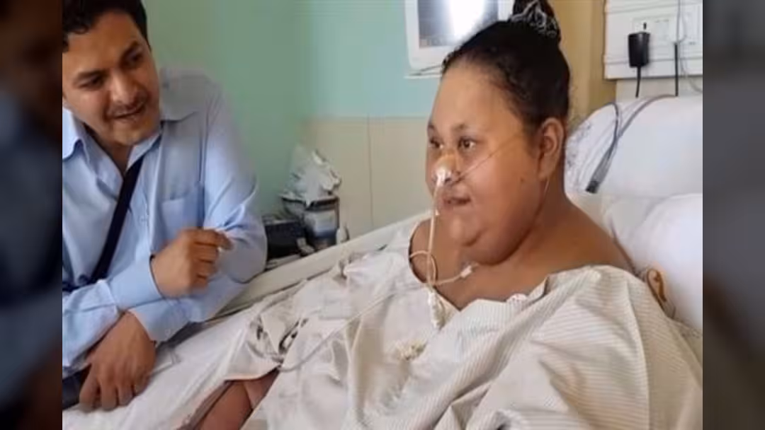 جراحة ناجحة تفقد مصرية 250 كيلوغراماً من وزنها خلال شهرين