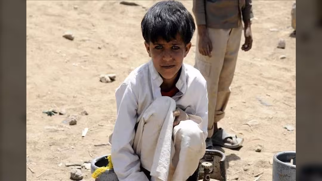 الأمم المتحدة: نصف مليون طفل يمني يوشكون على الموت