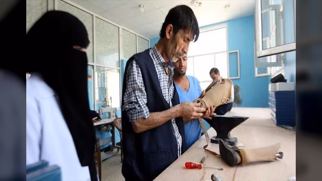 خبير تركي يصنع أطرافاً لتأهيل معاقي الحرب في اليمن