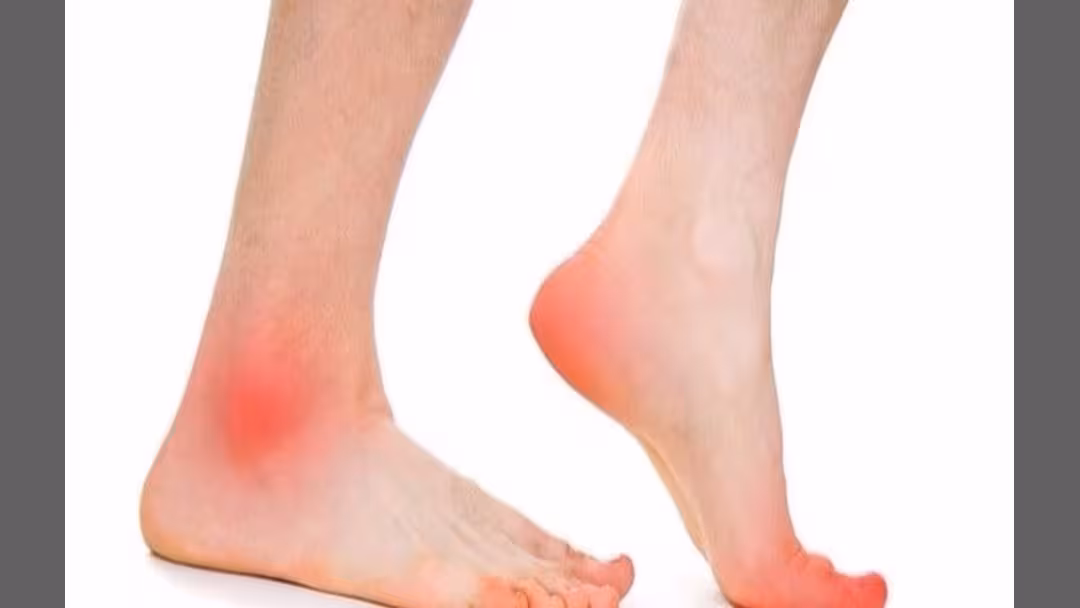 آلام الأرجل قد تشير إلى التهاب عرق النسا