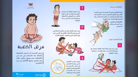الإعلان عن ثلاث وفيات بسبب مرض الحصبة في البيضاء