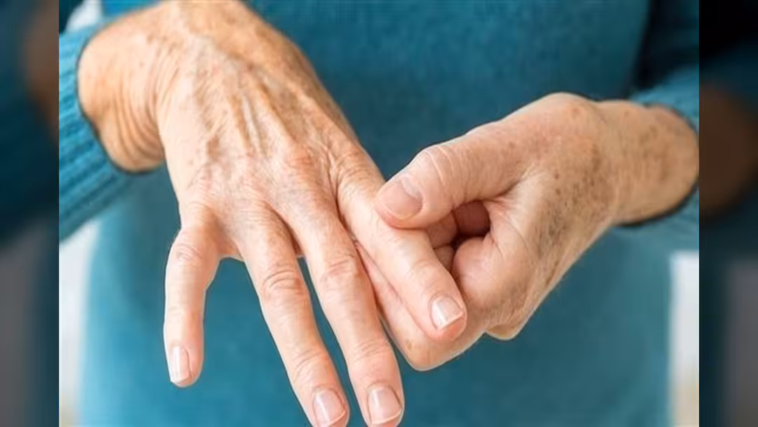 أعراض تنذر بالتهاب المفاصل الروماتويدي.. تعرف عليها