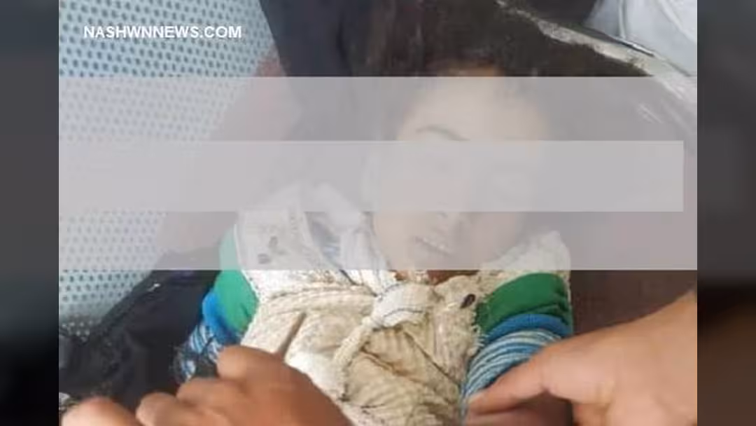 دعوات لمناصرة مع طفلة يمنية تعرضت لعنف والدها وأصيبت بكسور.. النص