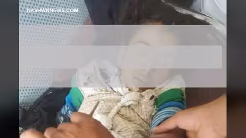 دعوات لمناصرة مع طفلة يمنية تعرضت لعنف والدها وأصيبت بكسور.. النص