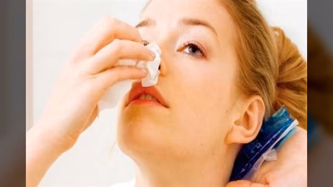 تعرف على أسباب نزيف الأنف