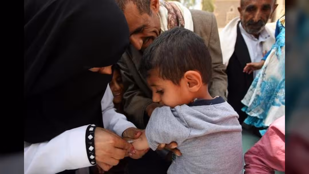وفاة 44 طفلاً بمرض الحصبة في ذمار خلال العام الجاري