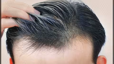 ستة عوامل تتوقف عليها زراعة الشعر .. تعرف عليها