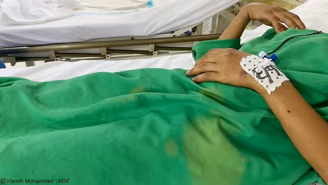 الحديدة: مقتل طفل وإصابة أمه وأخرين بقصف الحوثيين منزلهم في حيس