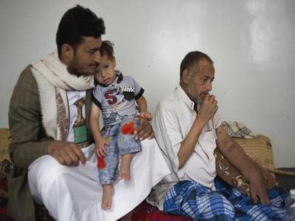 اليمن: مرضى الفشل الكلوي في مواجهة الموت