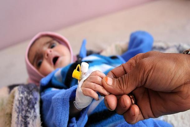 مرض الكوليرا في اليمن