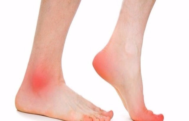 آلام الأرجل قد تشير إلى التهاب عرق النسا