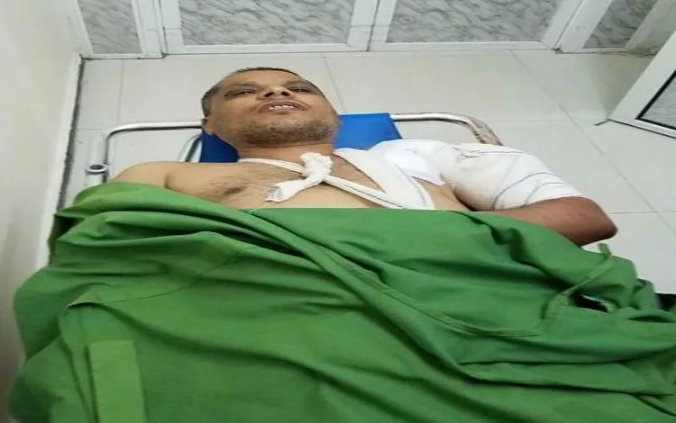 مدير مكتب التخطيط في تعز نبيل جامل ينجو من اغتيال