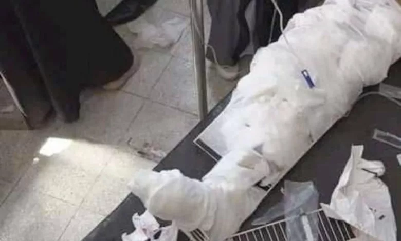 قتلى وجرحى أغلبهم أطفال بقصف الحوثي حياً في تعز