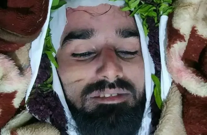 الشهيد حمدي عبدالرزاق الخولاني المعروف بالمكحل