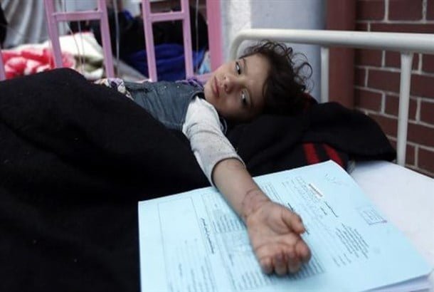 مرضى الكوليرا في اليمن